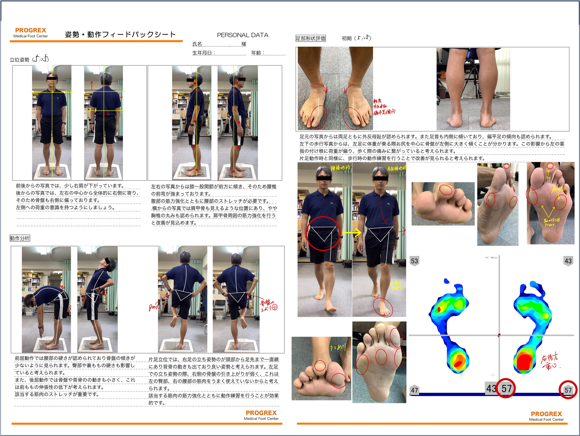 アセスメント